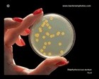 golden staphylococcus on petri dish